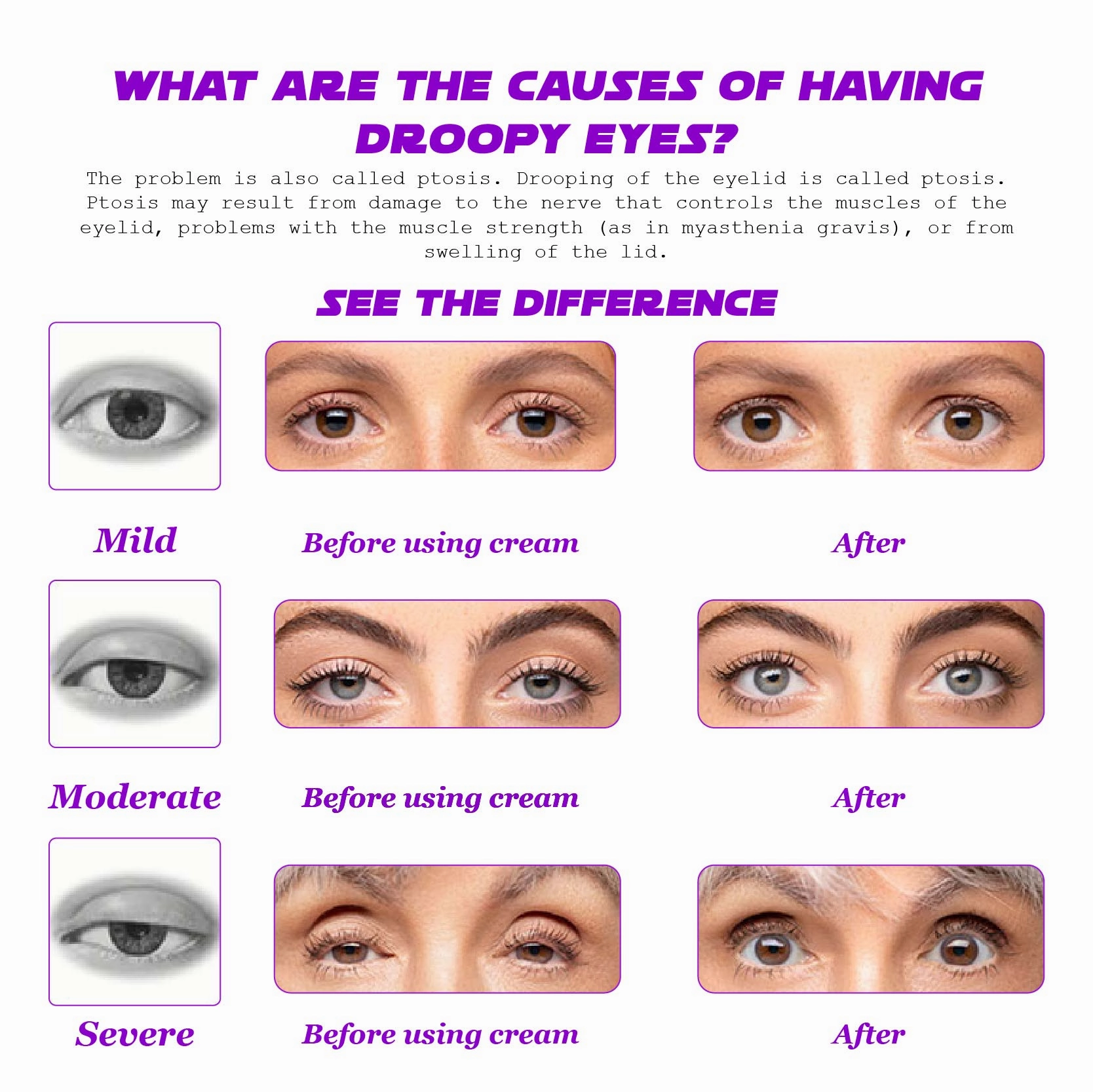 ATTDX AntiAging ProXylane Hydrating EyeCream