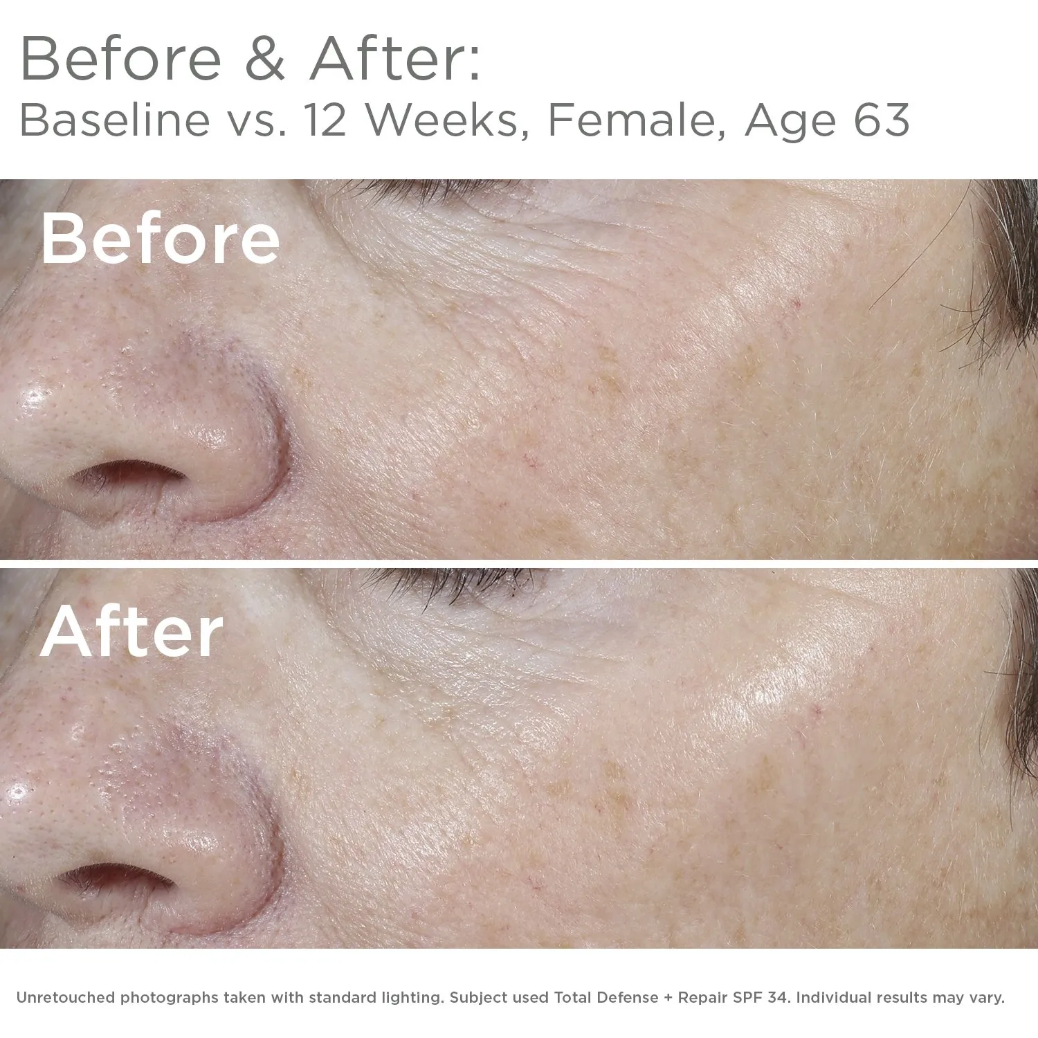 SkinMedica Total Defense   Repair SPF 34 Tinted Sunscreen for Face. This Lightweight, Facial Sunscreen is Ideal for Oily and/or Combination Skin, 2.3 Oz